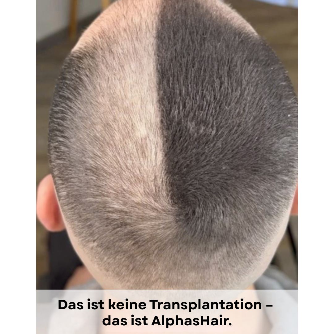 AlphasHair - dichtes Haar in Sekundenschnelle