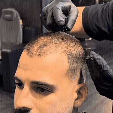 AlphasHair - dichtes Haar in Sekundenschnelle