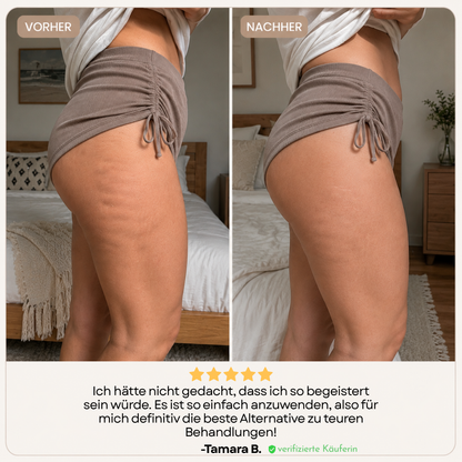 CelluRoll - 5 Minuten Gewebemassage für glatter wirkende Haut