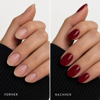 OneSecondnails Starter-Set