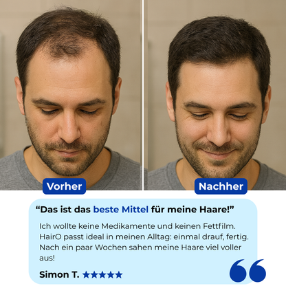 HairO - Präzisions-Stick für feiner werdende Bereiche