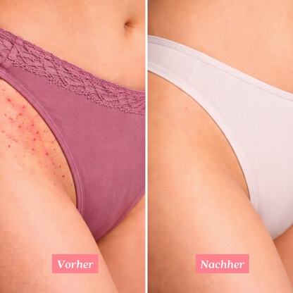 Shavelle - Nie wieder Rasierpickel nach der Rasur